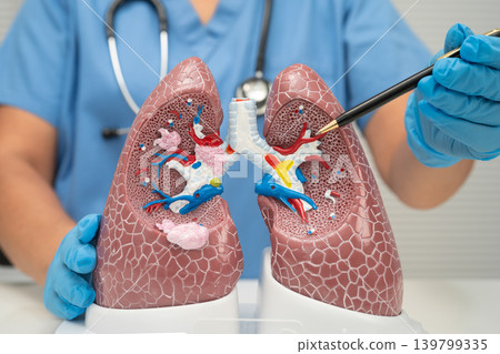 Pneumonia, lung cancer, Asian doctor with human lung model. Pneumonia, lung cancer, Asian doctor with human lung model. 139799335
