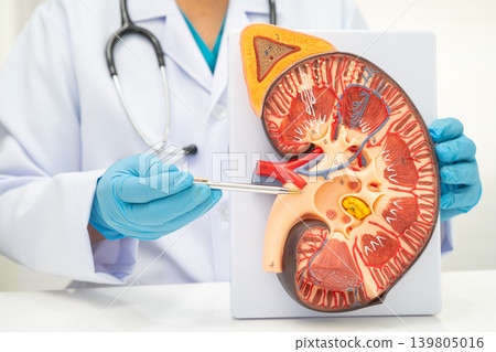 Chronic kidney disease, doctor with model for treatment urinary system, urology, Estimated glomerular filtration rate eGFR. Chronic kidney disease, doctor with model for treatment urinary system, urology, Estimated glomerular filtration rate eGFR. 139805016