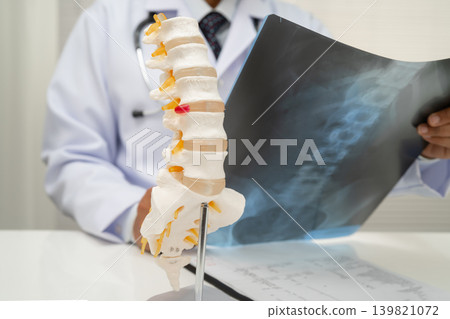 Doctor examining spine bone radiography xray film. Doctor examining spine bone radiography xray film. 139821072