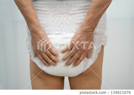 Asian senior woman patient wearing incontinence diaper. Asian senior woman patient wearing incontinence diaper. 139821076