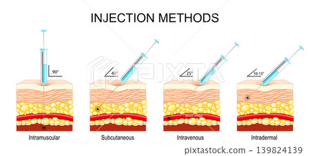 Injection methods. Intravenous, Intradermal, Subcutaneous, Intramuscular. 139824139