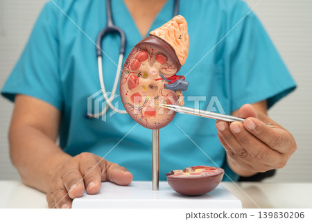 Chronic kidney disease, doctor with model for treatment urinary system, urology, Estimated glomerular filtration rate eGFR. Chronic kidney disease, doctor with model for treatment urinary system, urology, Estimated glomerular filtration rate eGFR. 139830206
