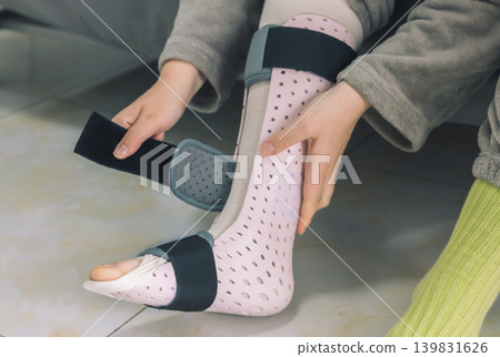 A person meticulously puts on a custom leg splint to aid in recovery. A person meticulously puts on a custom leg splint to aid in recovery. 139831626