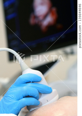 Kyiv, Ukraine - May 21, 2026: A modern ultrasound machine. An ultrasound examination of a pregnant woman. An ultrasound machine with AI. A woman undergoing a fetal ultrasound. An ultrasound machine Kyiv, Ukraine - May 21, 2026: A modern ultrasound machine. An ultrasound examination of a pregnant woman. An ultrasound machine with AI. A woman undergoing a fetal ultrasound. An ultrasound machine 139844646
