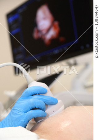 Kyiv, Ukraine - May 21, 2026: A modern ultrasound machine. An ultrasound examination of a pregnant woman. An ultrasound machine with AI. A woman undergoing a fetal ultrasound. An ultrasound machine Kyiv, Ukraine - May 21, 2026: A modern ultrasound machine. An ultrasound examination of a pregnant woman. An ultrasound machine with AI. A woman undergoing a fetal ultrasound. An ultrasound machine 139844647