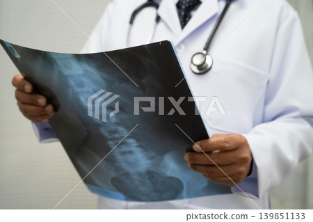 Doctor examining spine bone radiography xray film. Doctor examining spine bone radiography xray film. 139851133