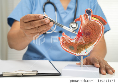 Stomach disease, doctor with anatomy model for study diagnosis and treatment in hospital. 139851371