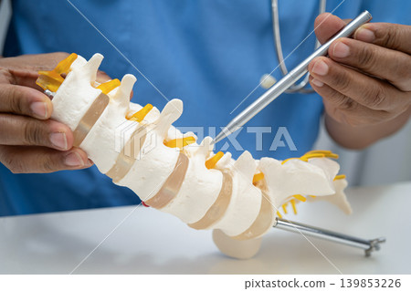 Asian doctor holding spinal nerve and bone model, Lumbar spine displaced herniated disc fragment for treatment medical in the orthopedic department. Asian doctor holding spinal nerve and bone model, Lumbar spine displaced herniated disc fragment for treatment medical in the orthopedic department. 139853226