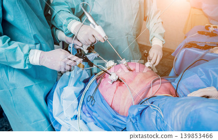 Process of gynecological surgery operation using laparoscopic equipment. Process of gynecological surgery operation using laparoscopic equipment. 139853466