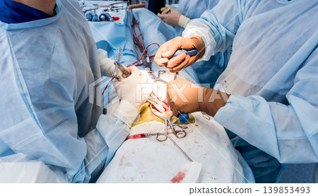 Spinal surgery. Group of surgeons in operating room Spinal surgery. Group of surgeons in operating room 139853493
