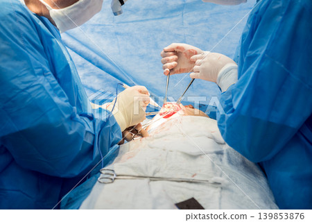 Surgery to remove the breast and replace it with an implant. Surgery to remove the breast and replace it with an implant. 139853876