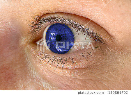 Macro closeup of human eye with blue contact lens during ophthalmology vision diagnostics. Detailed iris texture for optometry eyesight testing eye care and medical examination. 139861702