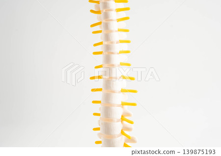 Spinal nerve and bone, Lumbar spine displaced herniated disc fragment, Model for treatment medical in the orthopedic department. Spinal nerve and bone, Lumbar spine displaced herniated disc fragment, Model for treatment medical in the orthopedic department. 139875193