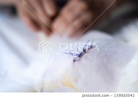 Focused clinical scene showing delicate suturing with sterile equipment and careful hand movements 139883042