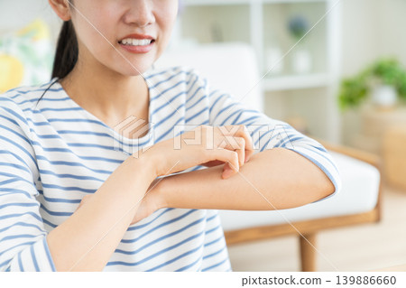 Young woman with itchy skin 139886660