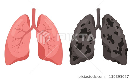 Dark Gray Damaged Smokers Lung Anatomy Icon Dark Gray Damaged Smokers Lung Anatomy Icon 139895027
