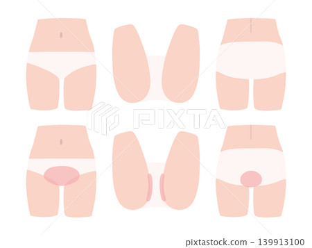A set of illustrated guides explaining the treatment areas and locations for VIO hair removal. A set of illustrated guides explaining the treatment areas and locations for VIO hair removal. 139913100