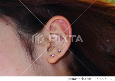 Beautiful ears 139926989