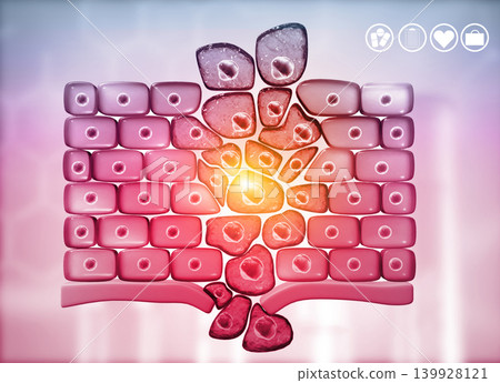 Cancer cells growing, medical background Cancer cells growing, medical background 139928121