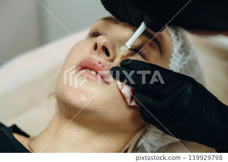 Making the lips bigger. Cosmetologist performing a facial injection procedure in a beauty clinic Making the lips bigger. Cosmetologist performing a facial injection procedure in a beauty clinic 139929798