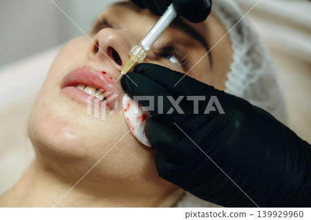 Making the lips bigger. Cosmetologist performing a facial injection procedure in a beauty clinic Making the lips bigger. Cosmetologist performing a facial injection procedure in a beauty clinic 139929960