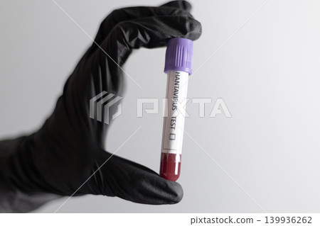 Hand Holding Hantavirus Test Blood Sample Tube Hand Holding Hantavirus Test Blood Sample Tube 139936262