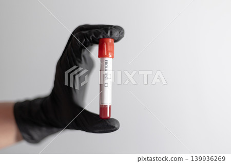 Hand Holding Ebola Test Blood Sample Tube Hand Holding Ebola Test Blood Sample Tube 139936269