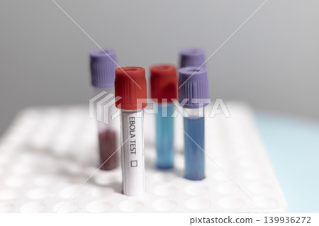 Ebola and Medical Test Tubes in Rack 139936272