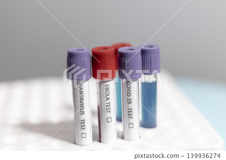 Medical Test Tubes Labeled for Hantavirus Ebola and Covid 19 Medical Test Tubes Labeled for Hantavirus Ebola and Covid 19 139936274
