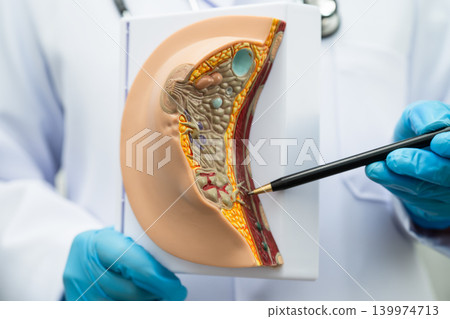 Doctor holding female breast human anatomy model. 139974713