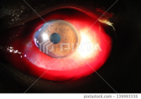 Anterior segment image demonstrating diffuse chemosis across the bulbar conjunctiva 139993338