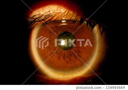 Ophthalmic close-up image revealing iris crypts on the anterior iris surface Ophthalmic close-up image revealing iris crypts on the anterior iris surface 139993664