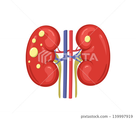 Kidney cysts disease. Medical research or treatment therapy. Renal anatomy icon. Vector illustration in flat cartoon style 139997919