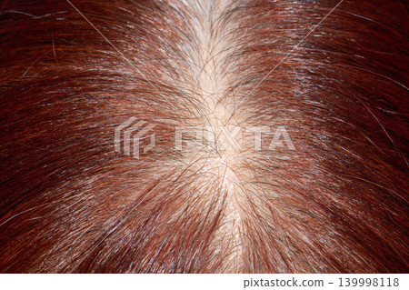 Senior aged asian woman concern about gray hair in menopause. Senior aged asian woman concern about gray hair in menopause. 139998118