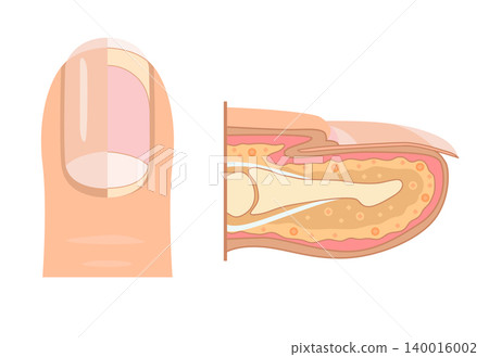 Anatomy of human finger nail. Medical diagram of the structure of the inside cross-section of the fingers. Vector infographic concept isolated on white background 140016002