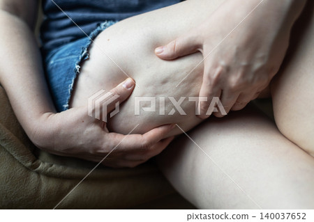 Close-up of a woman squeezing skin on her thigh, showing cellulite texture and orange peel effect. Concept of body aesthetic, female lipodystrophy, skin imperfections, and self-acceptance. Close-up of a woman squeezing skin on her thigh, showing cellulite texture and orange peel effect. Concept of body aesthetic, female lipodystrophy, skin imperfections, and self-acceptance. 140037652