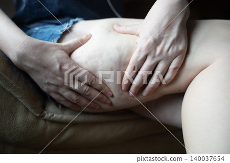 Close-up of a woman squeezing skin on her thigh, showing cellulite texture and orange peel effect. Concept of body aesthetic, female lipodystrophy, skin imperfections, and self-acceptance. Close-up of a woman squeezing skin on her thigh, showing cellulite texture and orange peel effect. Concept of body aesthetic, female lipodystrophy, skin imperfections, and self-acceptance. 140037654