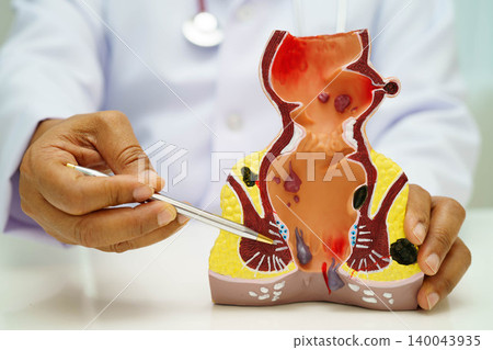 Uterus, doctor holding human anatomy model for study diagnosis and treatment in hospital. 140043935