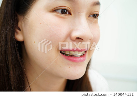 Asian woman with dental braces orthodontic treatment dental care. Asian woman with dental braces orthodontic treatment dental care. 140044131