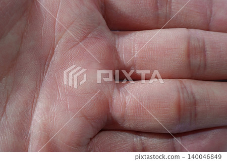 A close-up of a man's palm in his 40s. The image captures details such as palm lines, skin texture, and the feel of aging skin. A close-up of a man's palm in his 40s. The image captures details such as palm lines, skin texture, and the feel of aging skin. 140046849