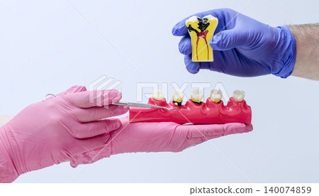 Dentists holding educational models showing external cavities and a cross-section of severe deep decay reaching the pulp. Pulpitis concept. Dentists holding educational models showing external cavities and a cross-section of severe deep decay reaching the pulp. Pulpitis concept. 140074859