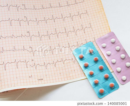 Electrocardiogram (ECG), health checkup, examination, waveform, health check, ECG test Electrocardiogram (ECG), health checkup, examination, waveform, health check, ECG test 140085001