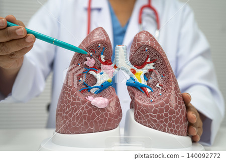 Pneumonia, lung cancer, Asian doctor with human lung model. Pneumonia, lung cancer, Asian doctor with human lung model. 140092772