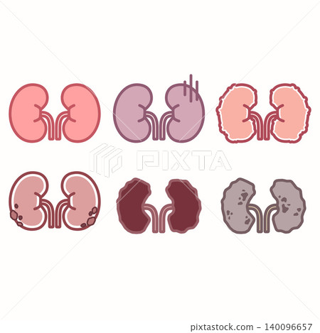 Human Kidney Anatomy and Various Renal Disease Icons Set 140096657