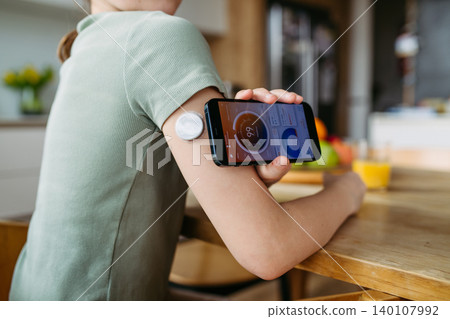 Teen girl with diabetes scanning glucose level using CGM sensor and smartphone. Teen girl with diabetes scanning glucose level using CGM sensor and smartphone. 140107992