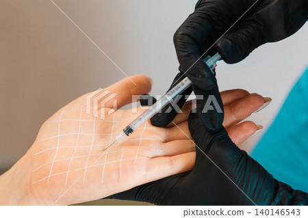 Procedure in beauty salon. Doctor makes injections of botulinum toxin on the client's female palm against hyperhidrosis. Close up. Concept of cosmetology Procedure in beauty salon. Doctor makes injections of botulinum toxin on the client's female palm against hyperhidrosis. Close up. Concept of cosmetology 140146543