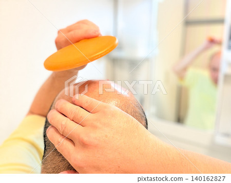 A middle-aged man suffering from hair loss A middle-aged man suffering from hair loss 140162827