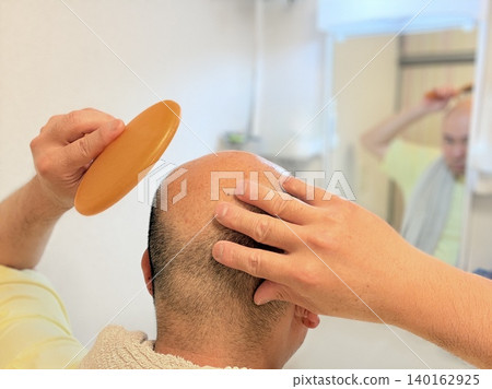 A middle-aged man suffering from hair loss A middle-aged man suffering from hair loss 140162925