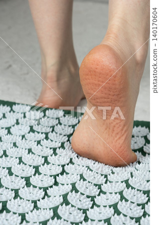 Footprints and Red Marks After Using Acupressure Mat Footprints and Red Marks After Using Acupressure Mat 140170604