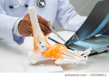 Doctor examining foot ankle joint bone radiography xray film. Doctor examining foot ankle joint bone radiography xray film. 140189651